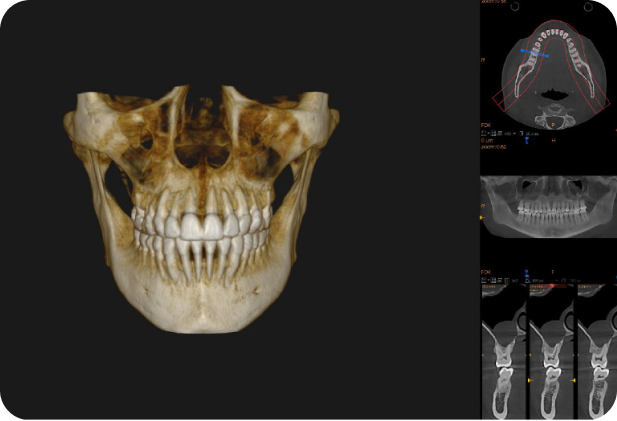Tomografía 3D ConeBeam
