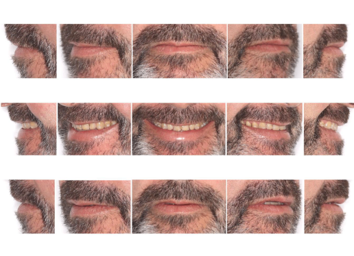 Fotografía dental extraoral