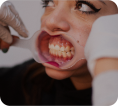 Fotografía dental