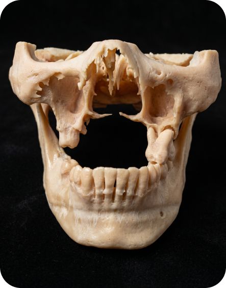 Impresión dental 3D